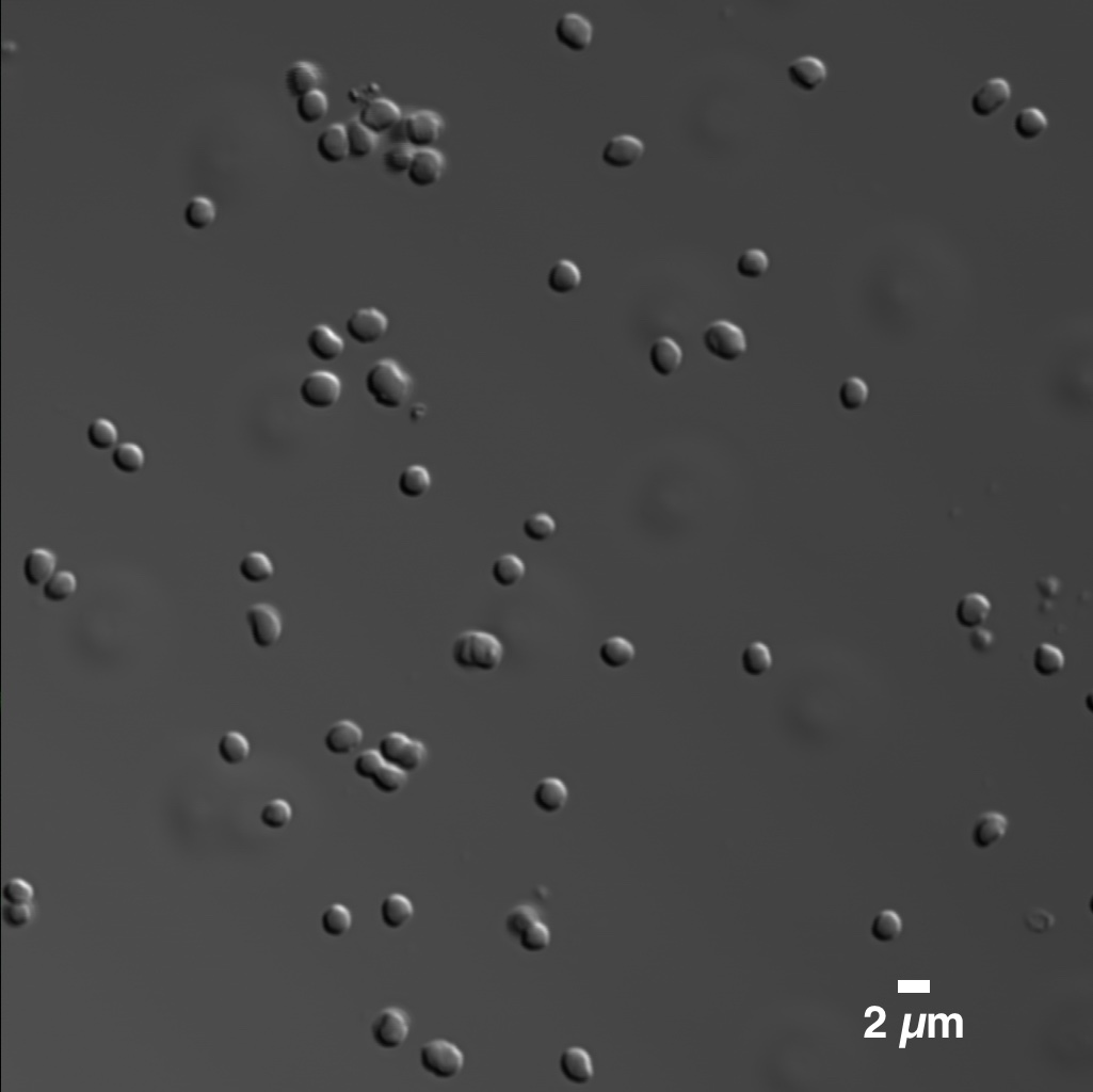 Methanosarcina cells using phase contrast microscopy